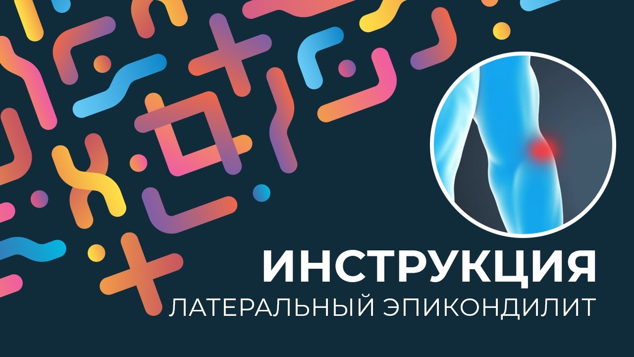 Kinexib - тейпирование латерального эпикондилита
