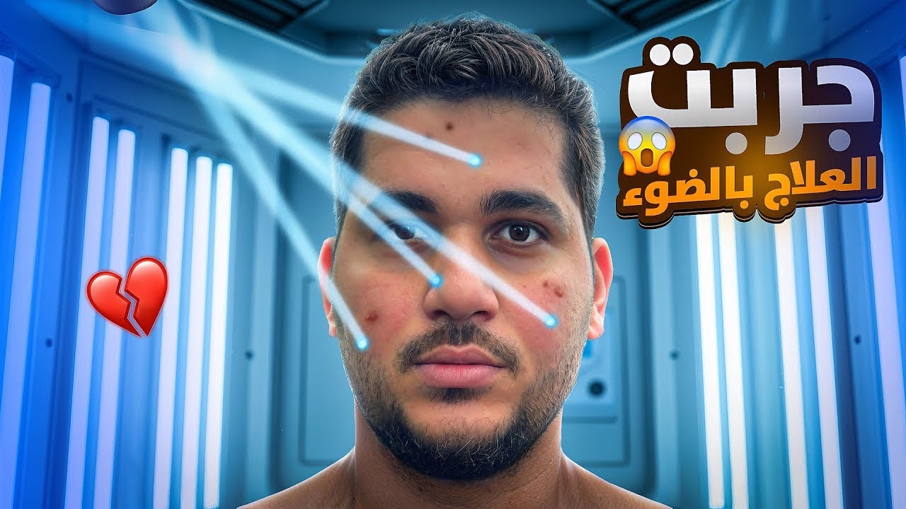 فلوق جربت افضل علاج للقشرة 🤯🔥