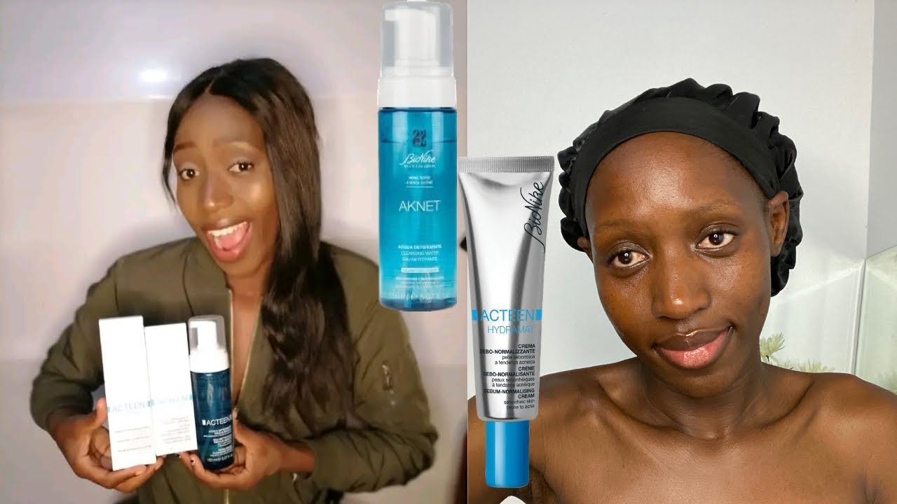 Acteen skin care products REVIEW|crear skin|bongah alora