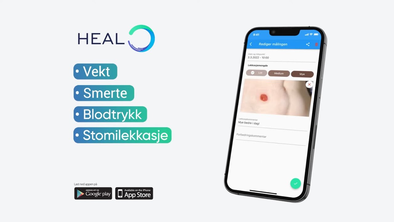 Historikk - Bjørn Einar Romøren