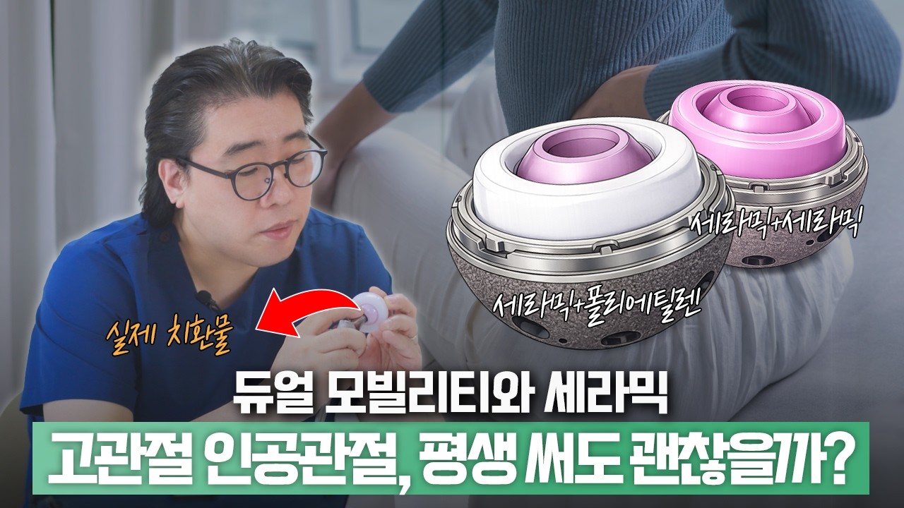 세라믹 vs 폴리에틸렌, 고관절 인공관절 소재 고민 끝! (feat. 듀얼모빌리티)