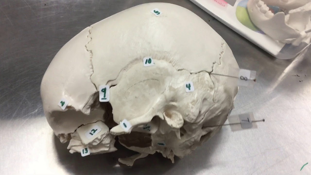 Skull Osteology: quick quiz #1 (Winter-2019)