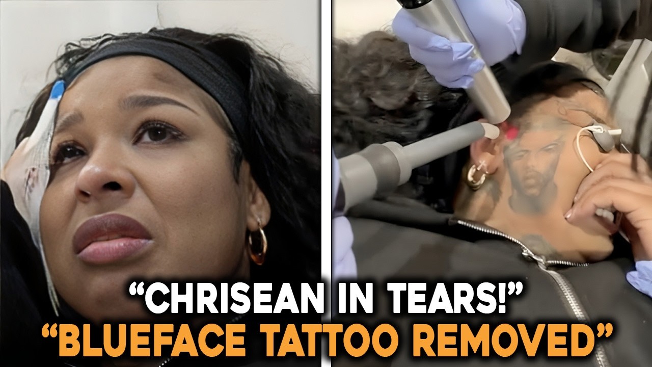 That Hurts’ — Chrisean Rock Breaks Down in Tears Removing Blueface Tattoo!