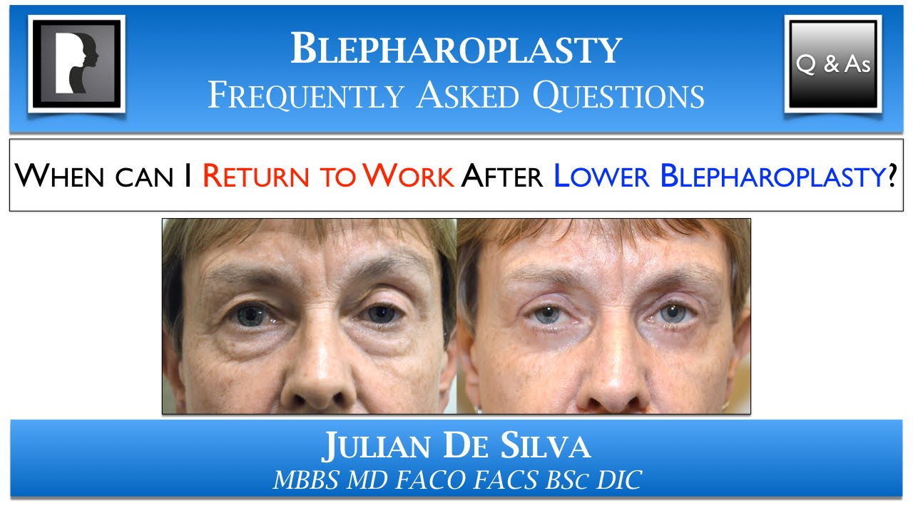 Lower Blepharoplasty Recovery: Returning to Work after Lower Eyelid Surgery