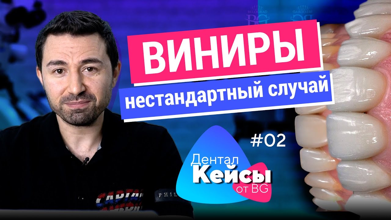 Керамические виниры и композитные реставрации. Дентал Кейсы от BG. #02