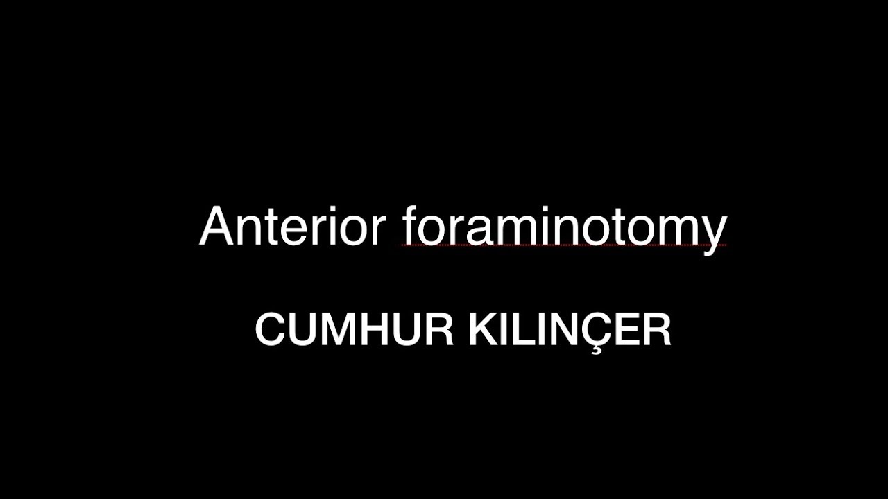 Cumhur Kılınçer  Anterior foraminotomy