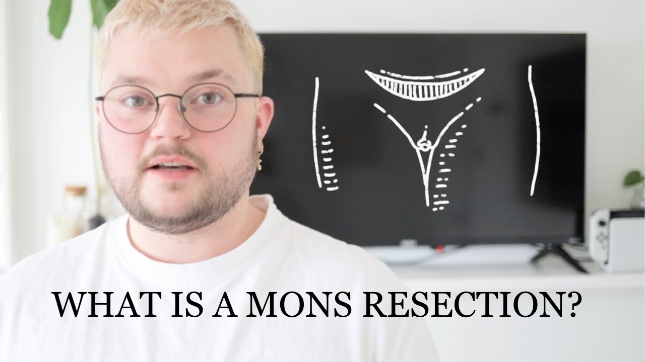 What is a Mons Resection? | FTM/TRANS BOTTOM SURGERY