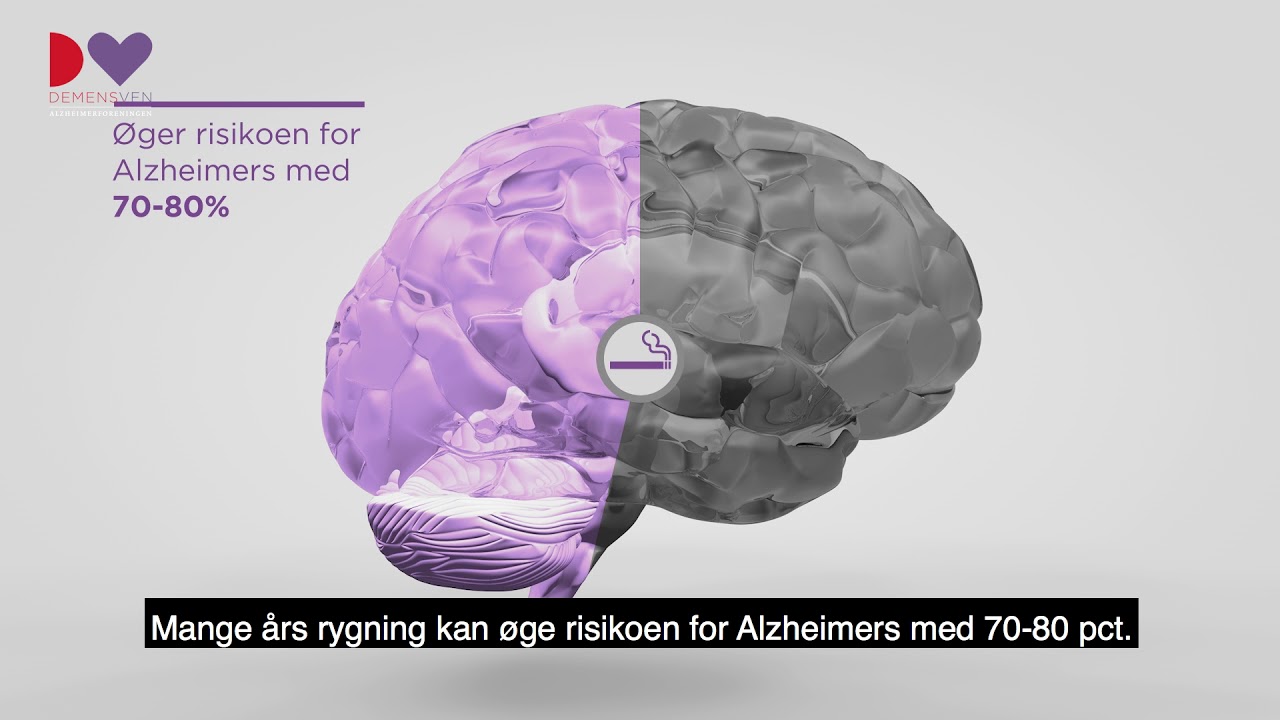 5 GODE RÅD til hvordan du reducerer risikoen for at få demens