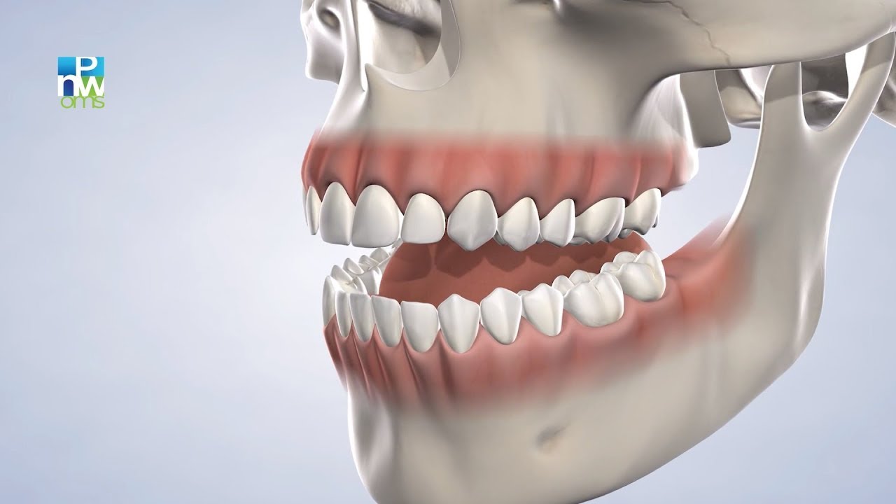 Instrucciones Pre-Operativas: Anestesia General | Pacific Northwest Oral & Maxillofacial Surgeons