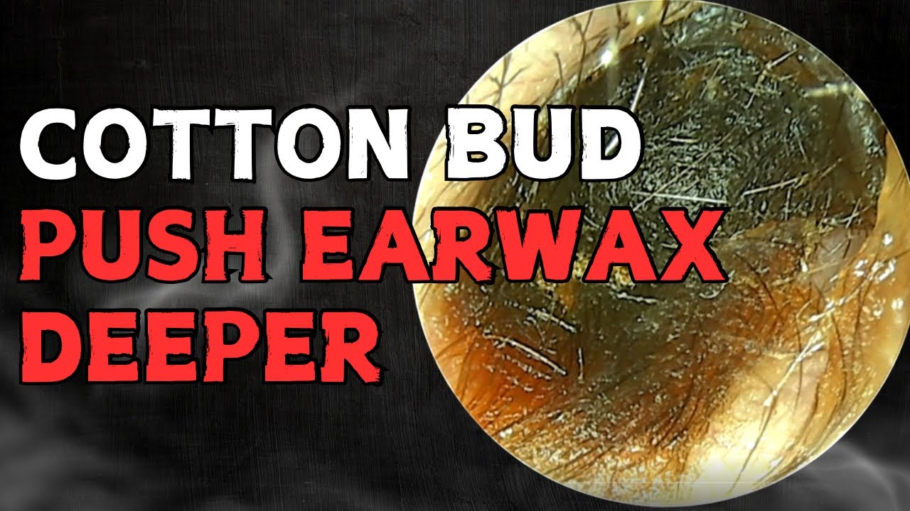 Cotton Bud Will Push Earwax Deeper