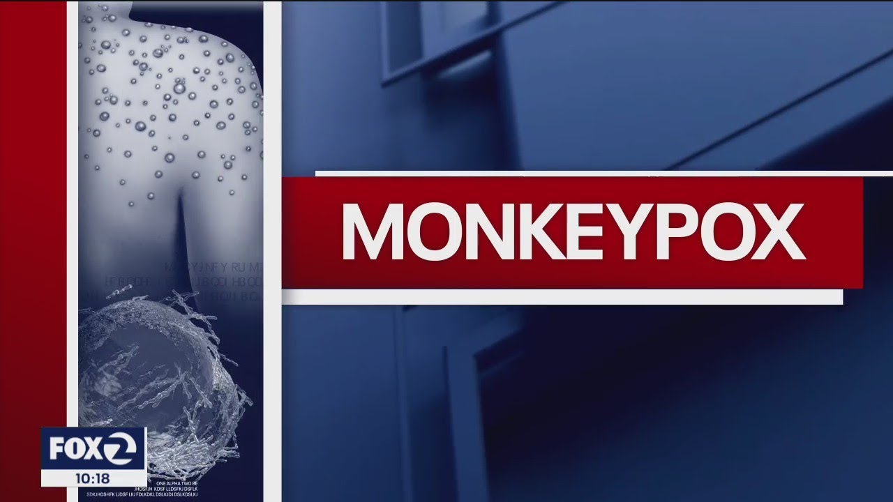 Oakland Pride celebrators to receive mpox vaccines