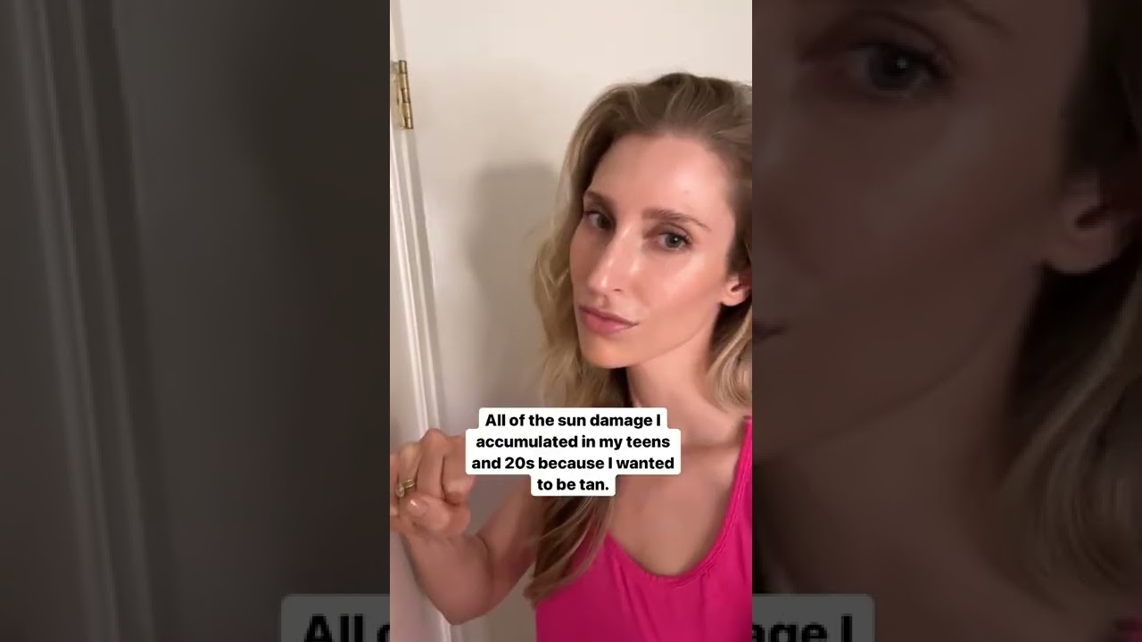 Sun damage follows you for a lifetime... | #shorts