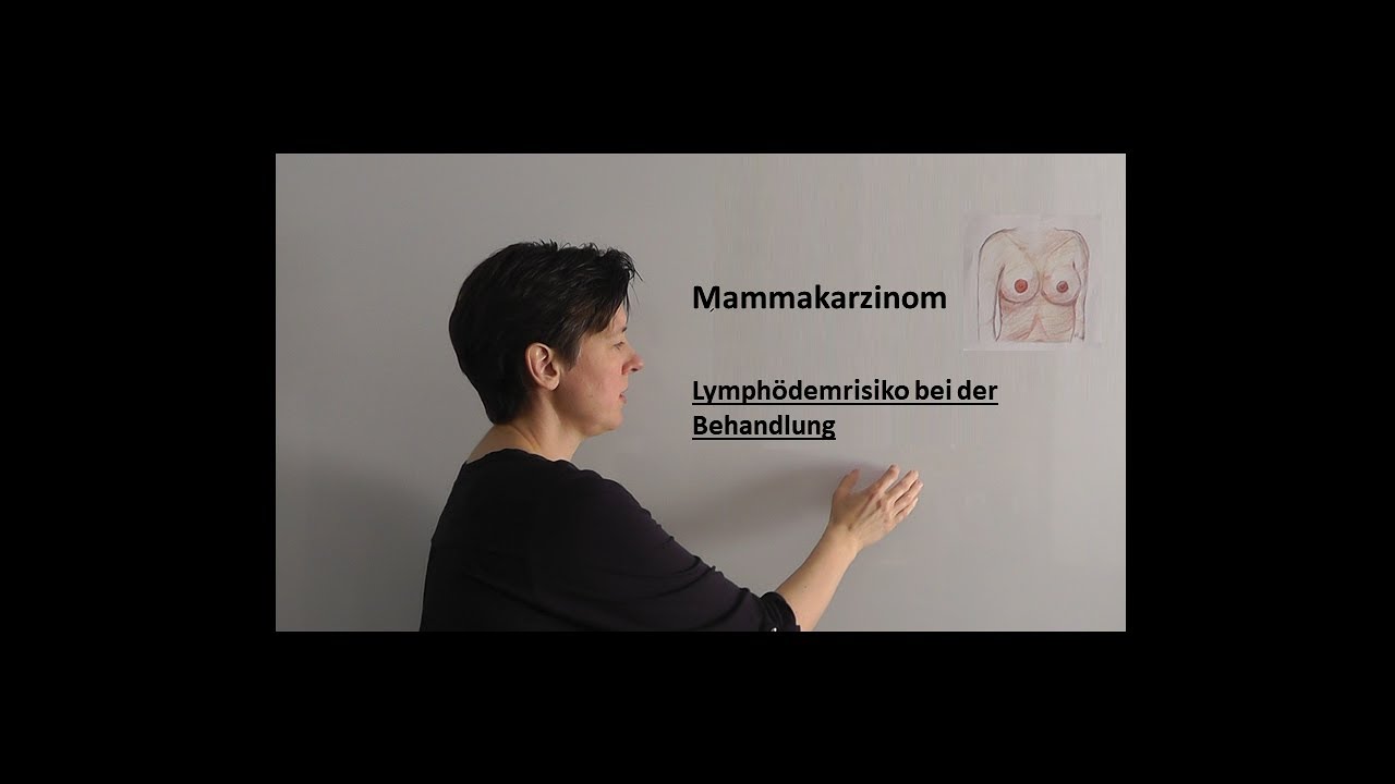 Lymphödemrisiko bei der Behandlung vom Mammakarzinom | Strahlentherapie Prof. Hilke Vorwerk