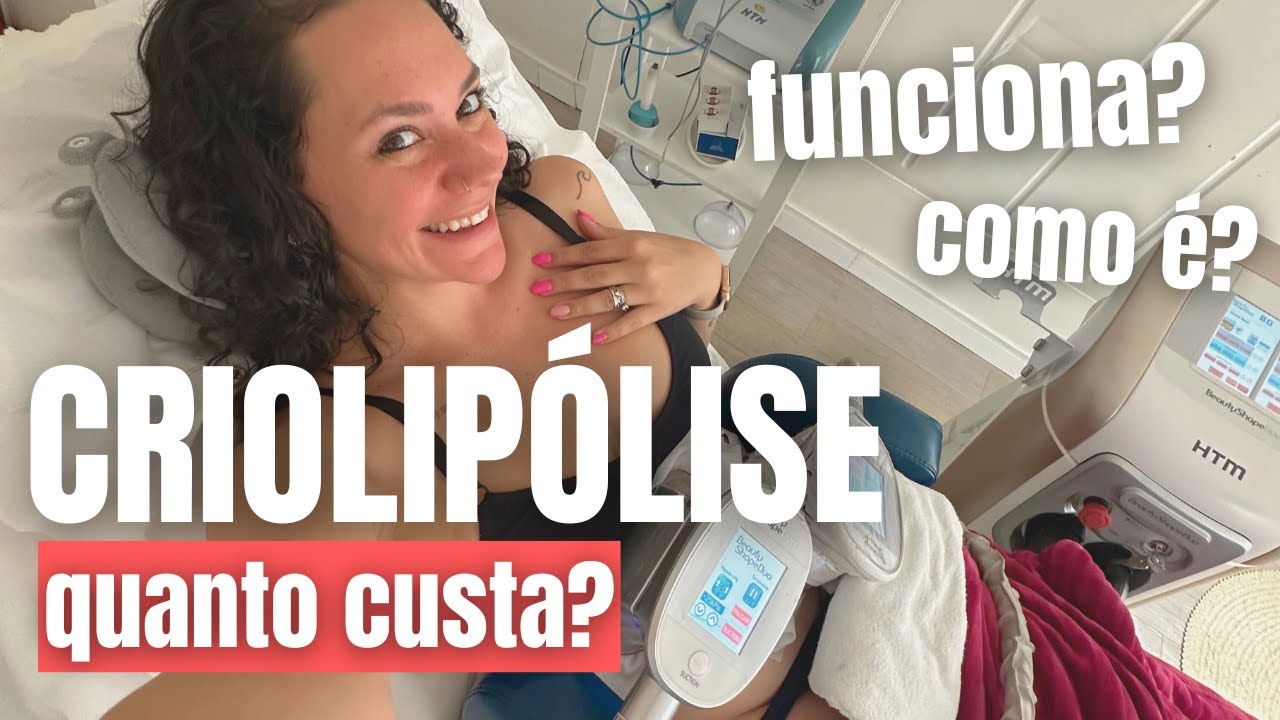 CRIOLIP&Oacute;LISE Como &eacute;? Funciona? Quanto custa? [Primeiros 15 dias]