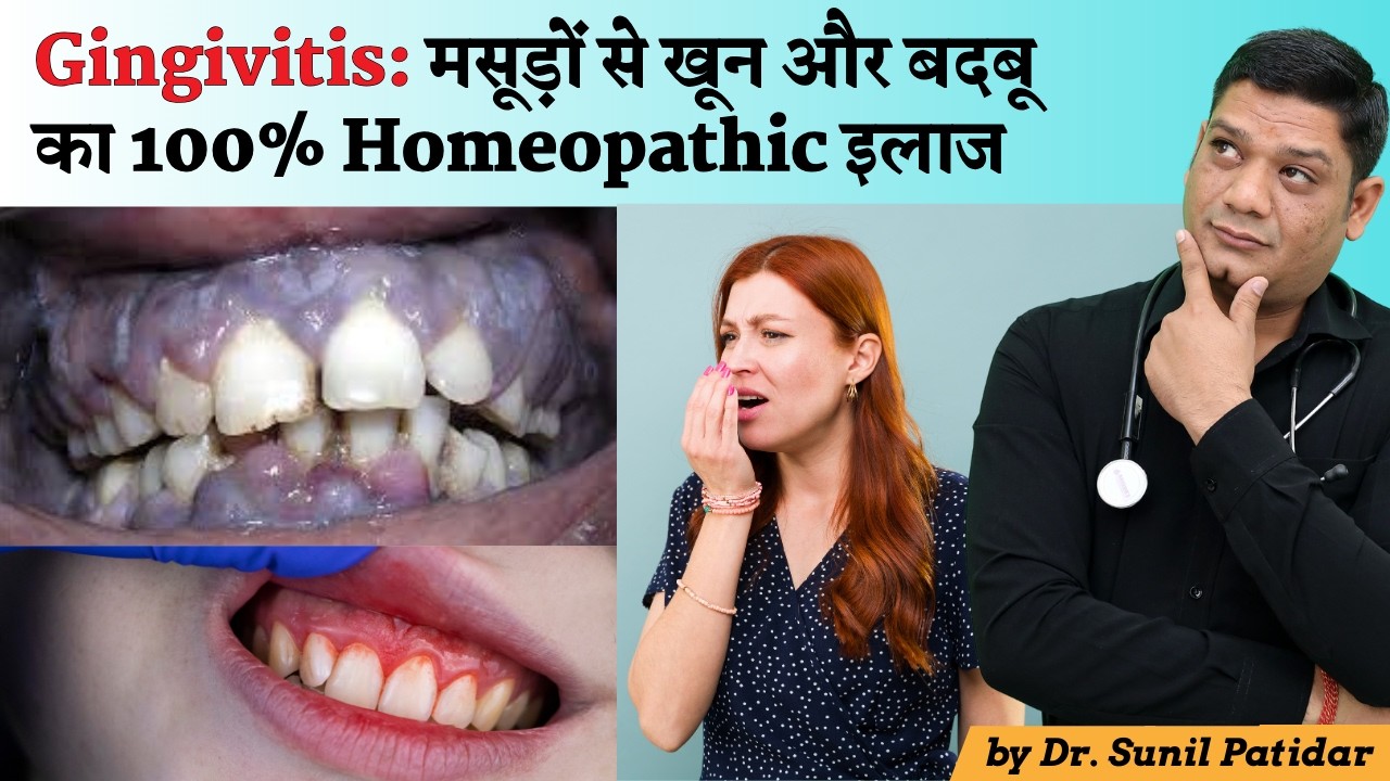 Gingivitis Homeopathic Treatment | Medicines for Bleeding and Bad Smell from Gum | Dr Sunil Patidar