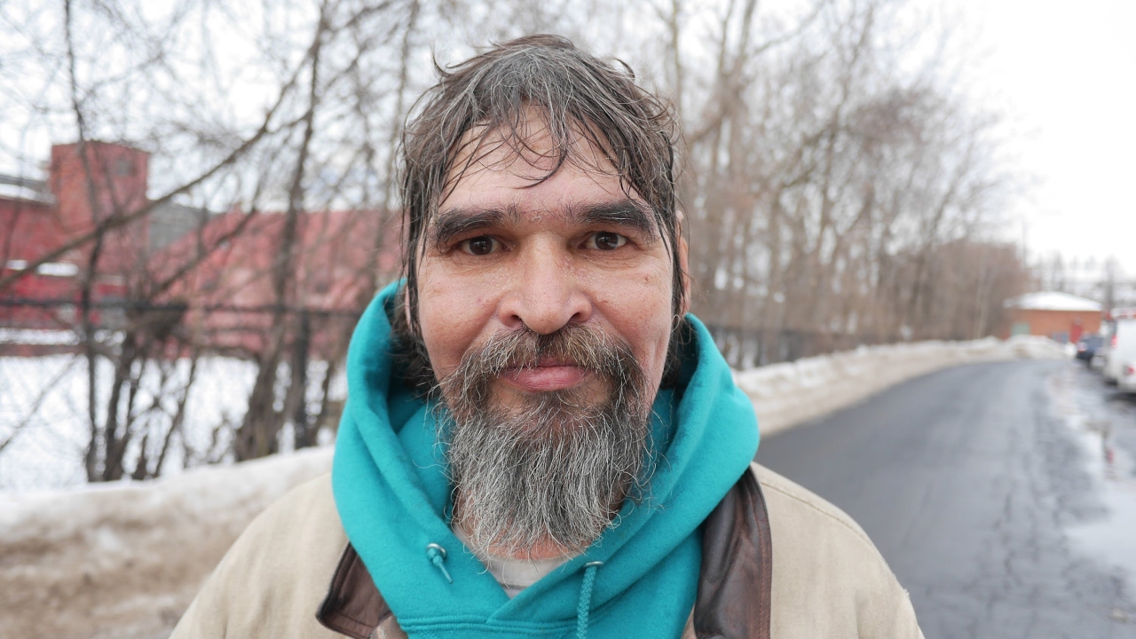 Randy's hand is frostbitten. He is homeless in Syracuse sleeping outside in the winter!