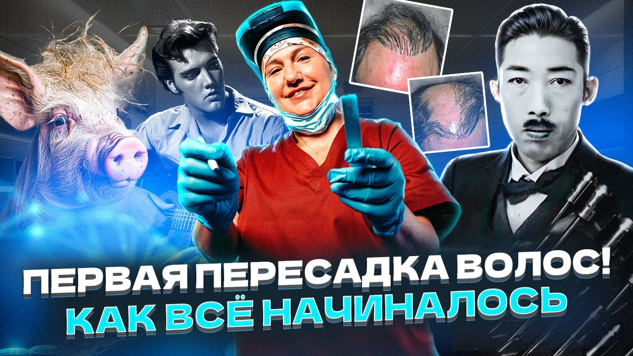 Пересадка волос в рубцы шрамы история пересадки волос