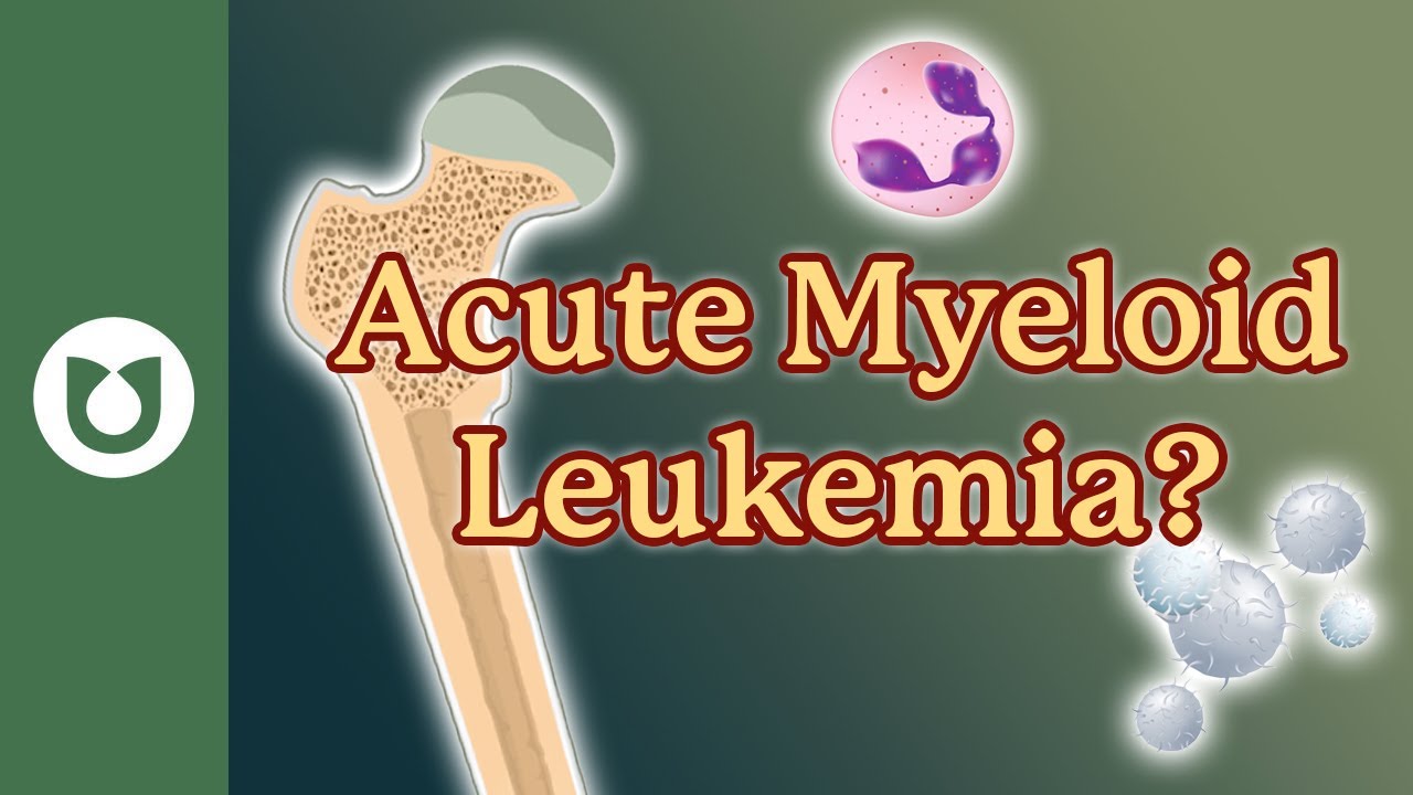 What is acute myeloid leukemia (AML)? #AML
