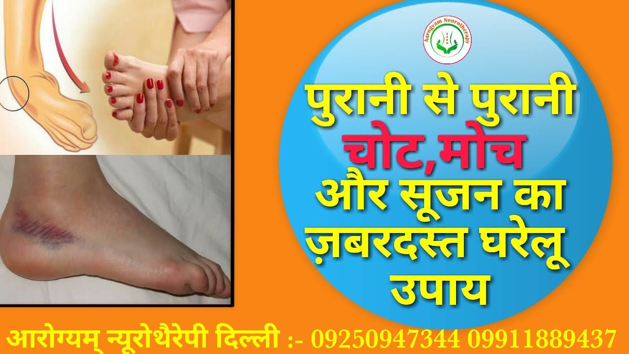 पुरानी से पुरानी चोट, मोच और सूजन का जबरदस्त घरेलू उपाय। purani se purani chot moch ka gharelu upay।