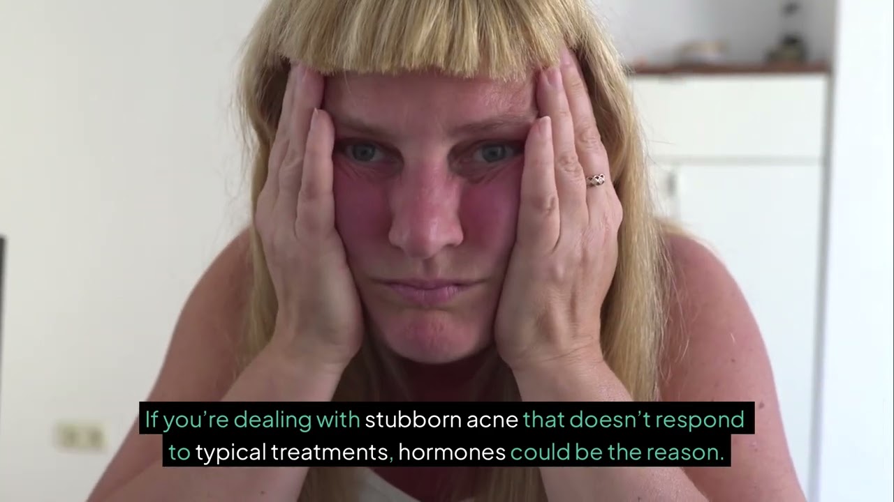 Top 10 Signs Of PCOS | What Every Woman Should Know