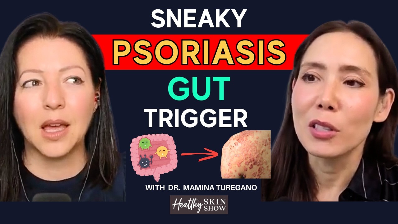 The Gut-Psoriasis Link: What Your Dermatologist Isn't Telling You | Dr. Mamina Turegano