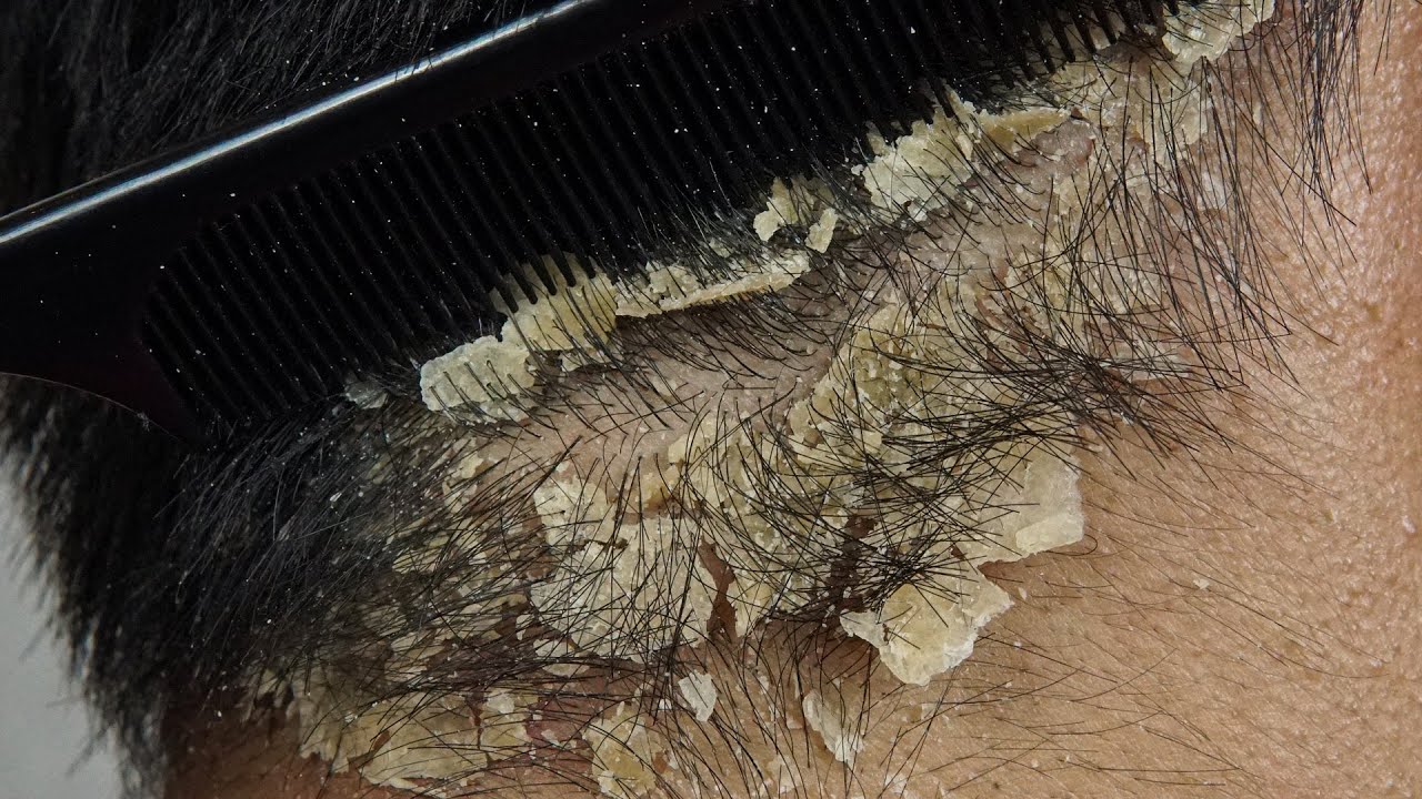 Ultimate Relaxation with Comb #DKMO2756