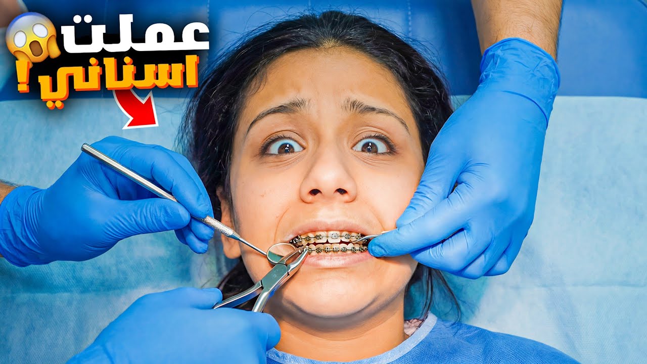 هيلين عملت تقويم لاسنانها واخيرا 😱 ليليان وهيفي اهتموا فيها كيف طلعت النتيجة 