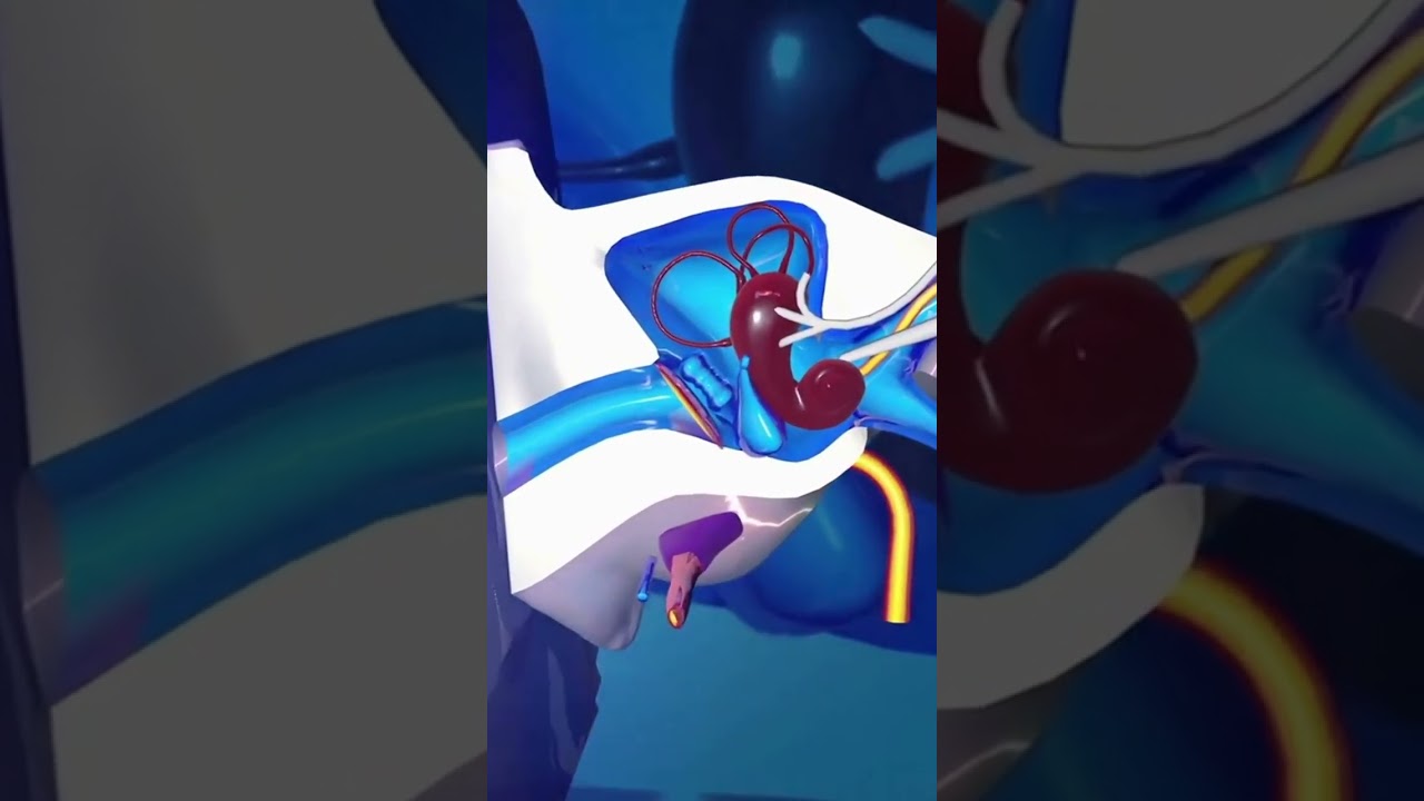 Тиннитус РАСКРЫТ &mdash; неожиданные причины звона в ушах №1