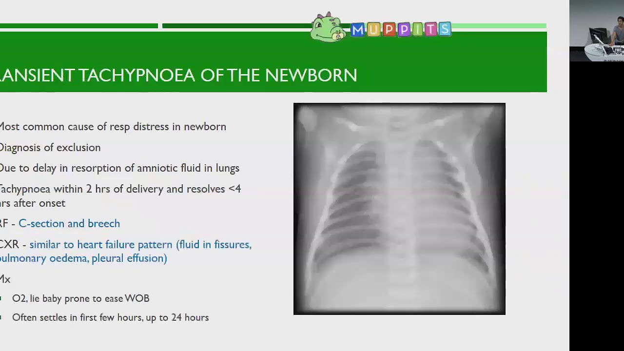 MUPPITS Year 4C Paediatrics Revision Lecture - Respiratory Conditions
