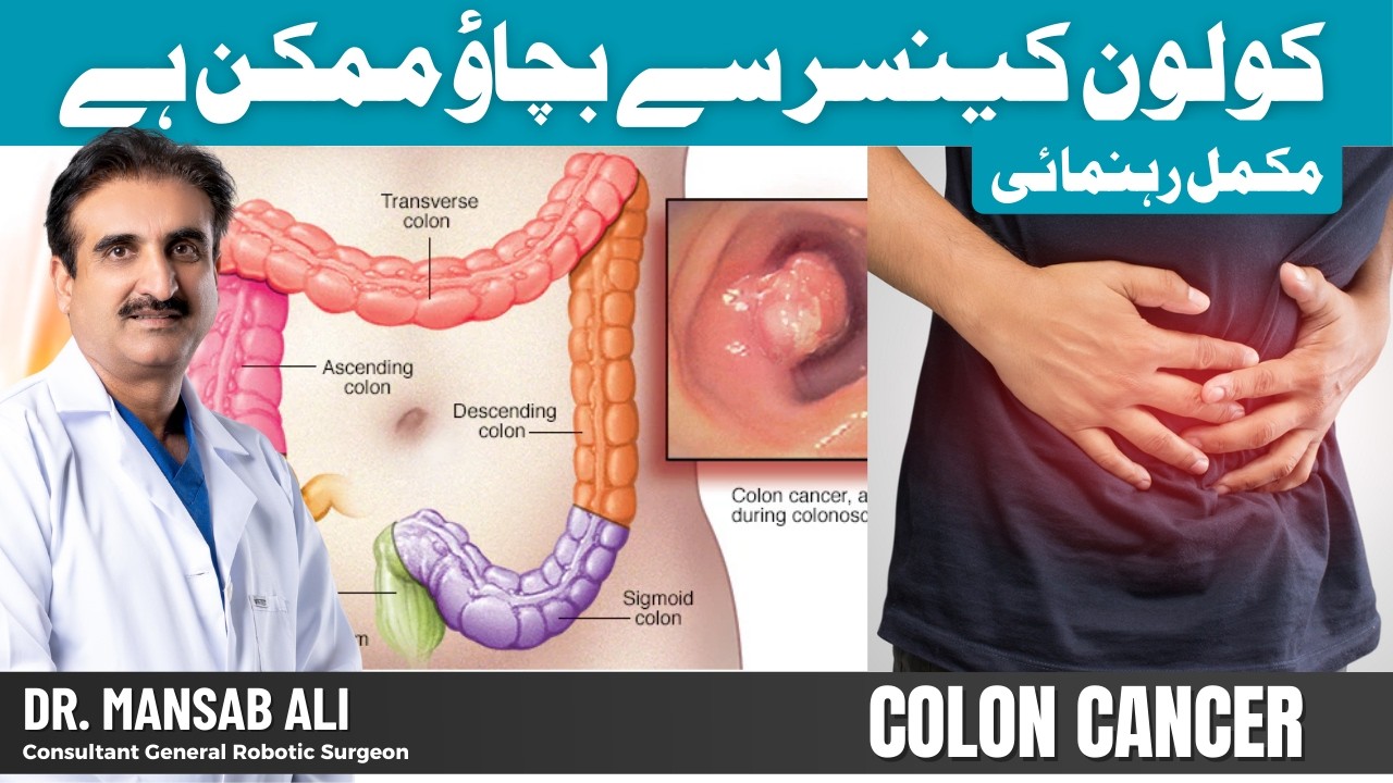 Why Is Colon Cancer Increasing in Young People? | Symptoms, Family History & Colonoscopy Myths