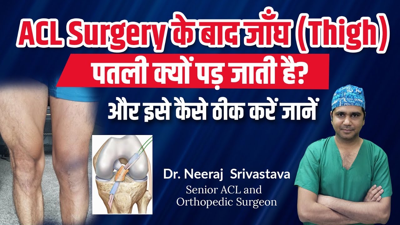 ACL Surgery के बाद जाँघ (Thigh) पतली क्यों पड़ जाती है? और इसे कैसे ठीक करें? l Dr Neeraj Srivastava