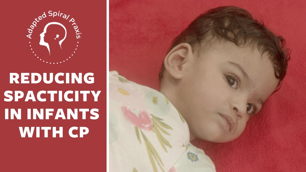 How Spasticity Can Be Reduced In Infants With CP