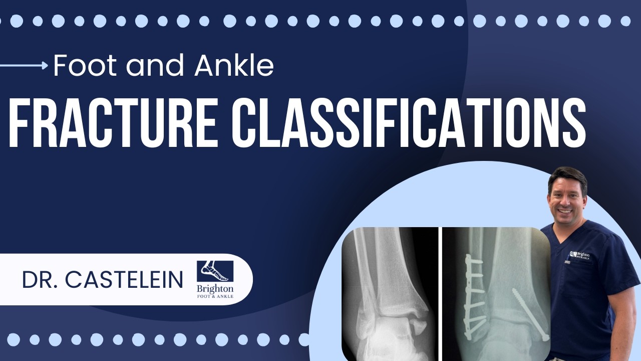 Foot Fracture Types Explained | Podiatrist Guide