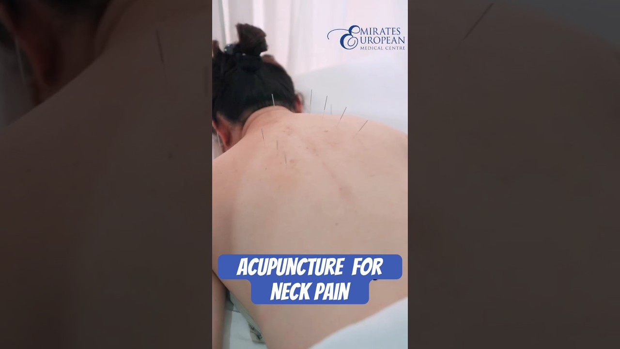Acupuncture for Neck Pain