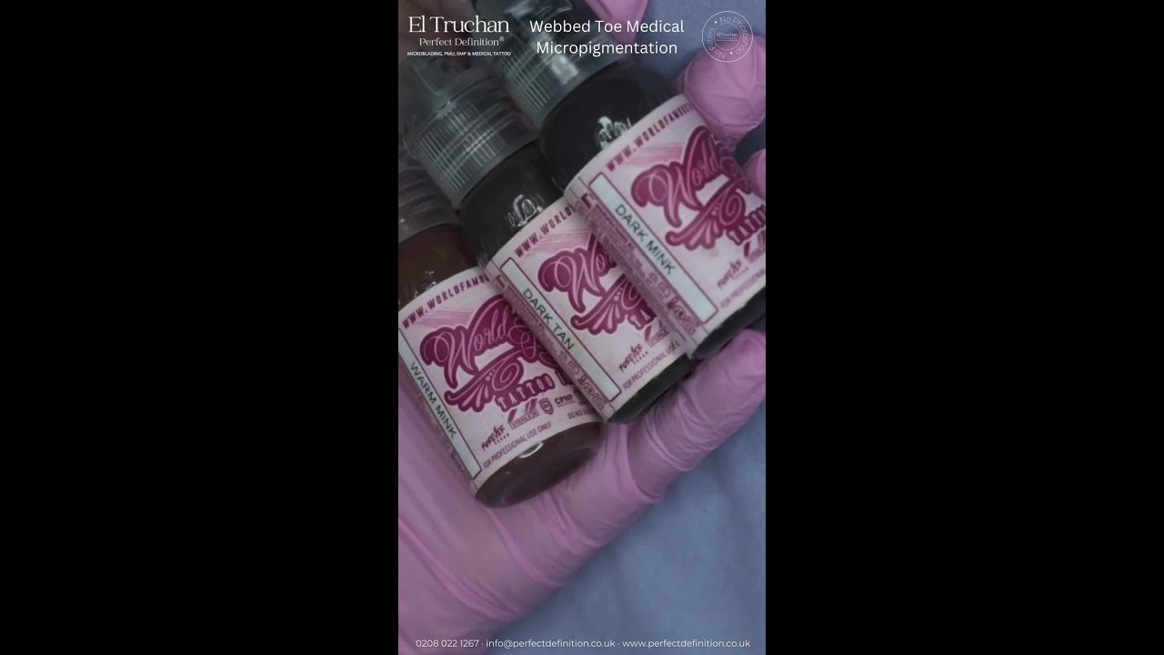 The Process of Webbed Toe Syndactyly Tattooing