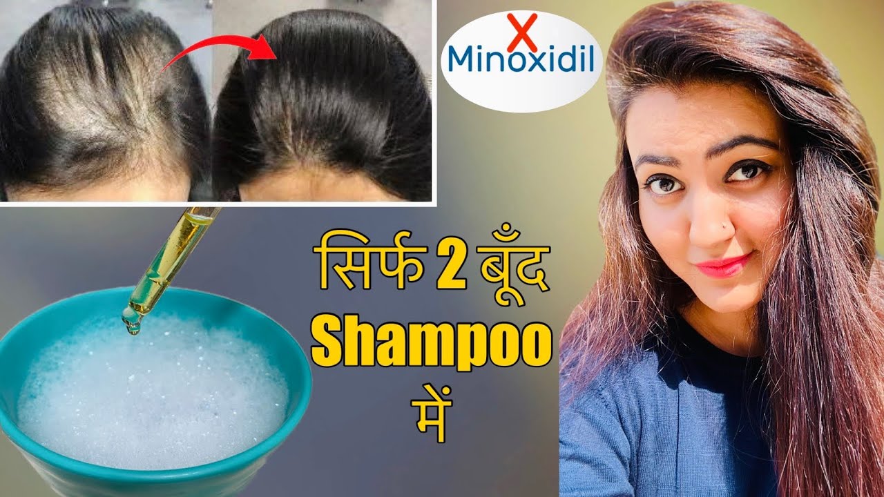 Thick Hair Challenge : शैम्पू में बस 2 बूंदे मिला के लगायें, बालों का झड़ना रोकें और Density 3X बढ़ाये