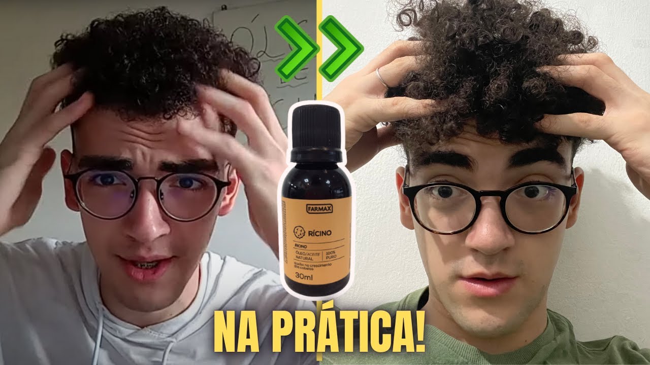 Passando Óleo de Rícino na Prática no Cabelo Cacheado Masculino (Passo a Passo)