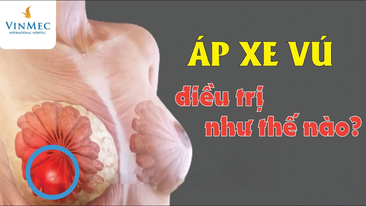 &Aacute;p xe v&uacute; điều trị như thế n&agrave;o?
