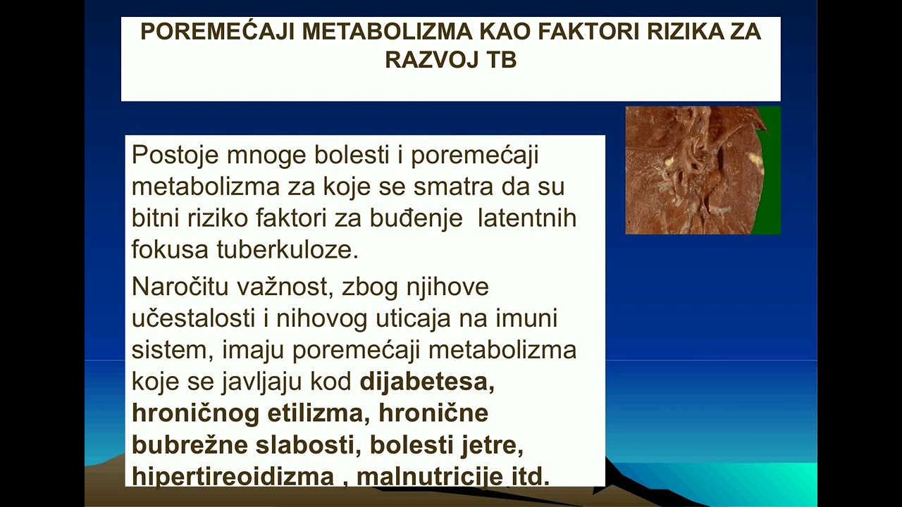 Tuberkuloza pluca u imunodeficijentnim stanjima Vesna Skodric Trifunovic   TUBERKULOZA U IMUNODEFICI