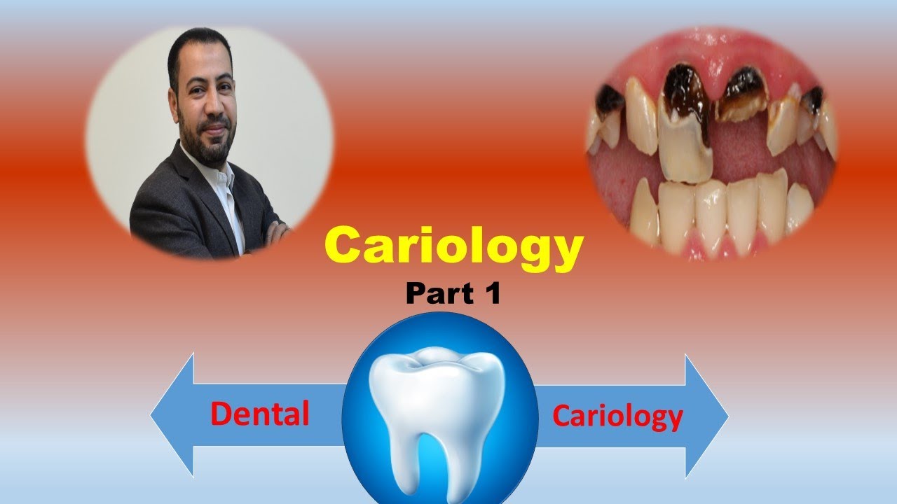 Dental Cariology   (part 1)