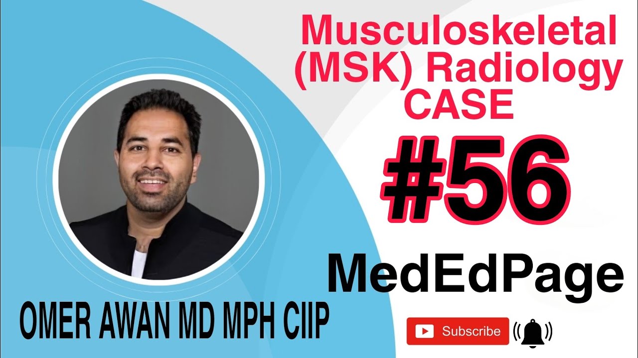 Musculoskeletal (MSK) Radiology CASE #56
