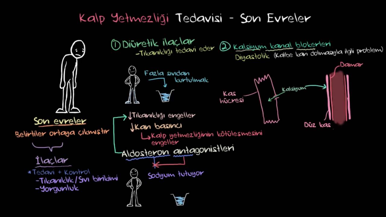 Kalp Yetmezliği Tedavisi – Son Evreler (Dolaşım Sistemi Hastalıkları)