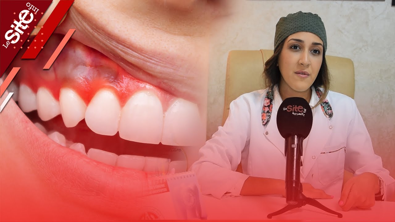 طبيبة أسنان مغربية تكشف معطيات هامة بشأن مرض اللثة وتقدم نصائح للمواطنين والمدخنين