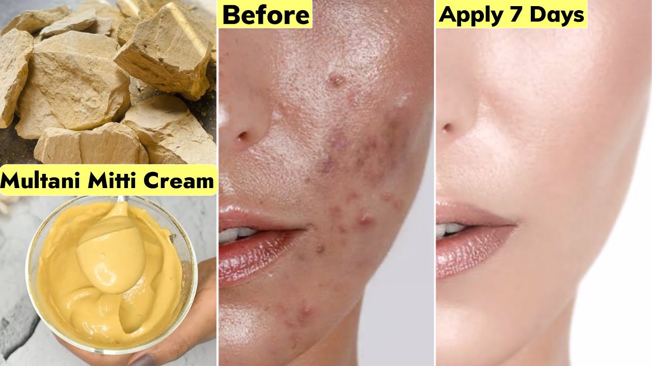 Indian👆🏼Skin Whitening Cream-Best Multani Mitti Cream-To Get Clear Smooth Fair Bright Skin-CHALLENGE