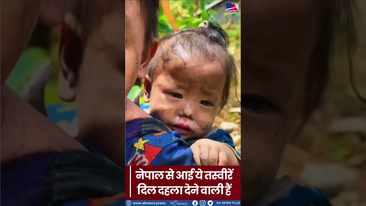 नेपाल में आए इस संकट के बीच हजारों बच्चे बेघर होकर अपनों की तलाश में हैं... #breakingnews  #news