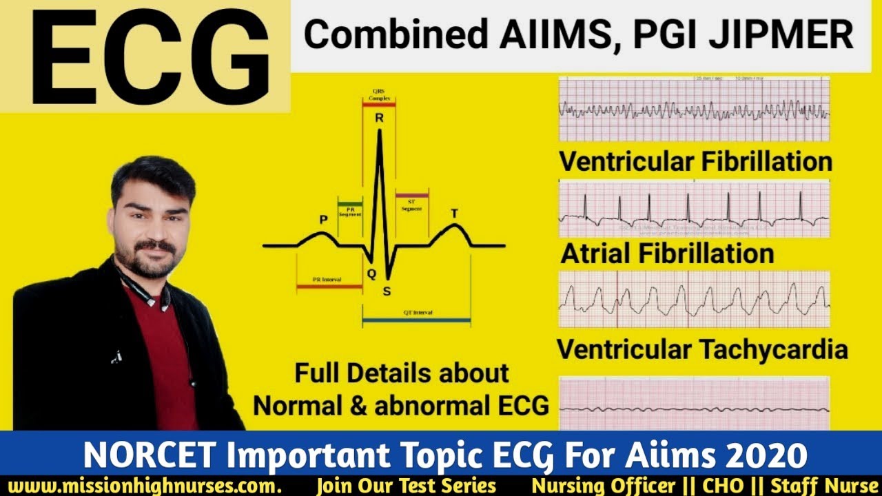 NORCET Exam ECG || ECG For Nursing Officer Exam 2020,ECG For NORCET Staff Nurse Exam,VT Abnormal ECG