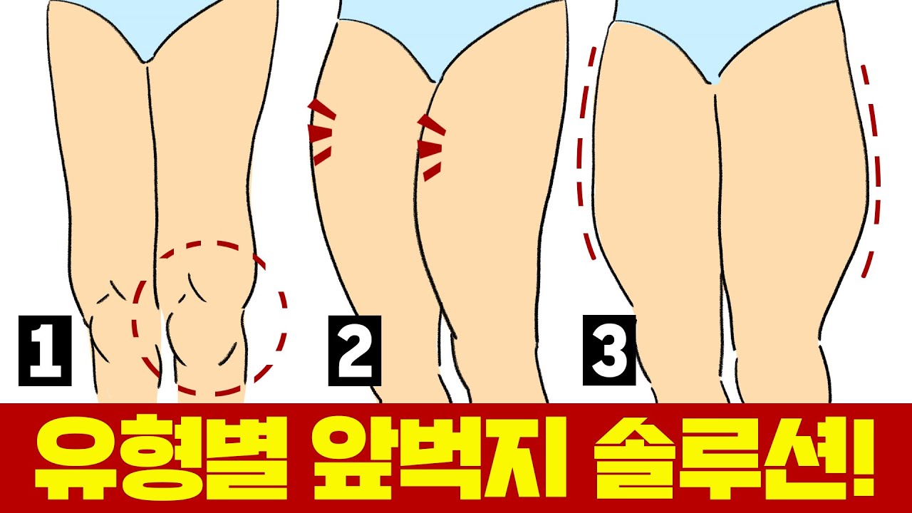 앞벅지 유형별 솔루션 총정리 (무릎벅지, 윗벅지, 바깥벅지)