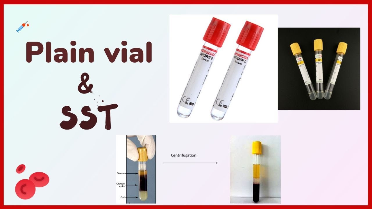 Plain tube - clot activator |  Blood collection tubes | vacutainer