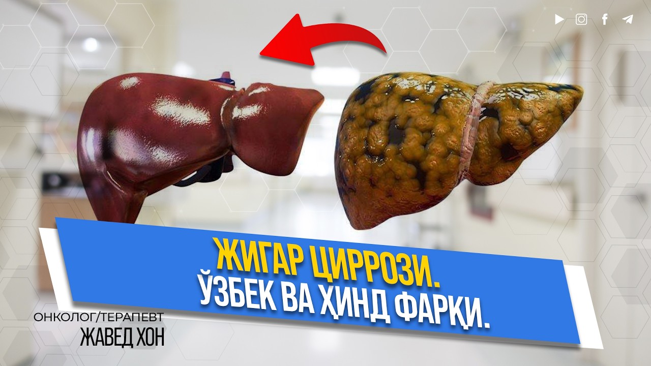 Ҳинд докторидан жигар циррози ҳақида ҳақиқатлар!