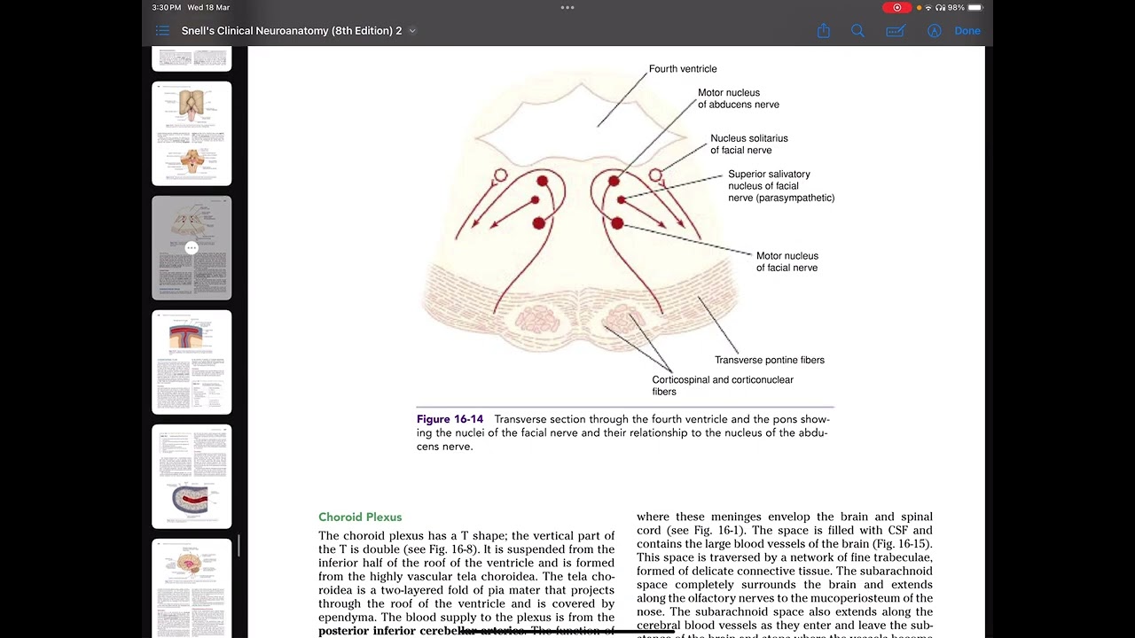Intracranial haemorrhage